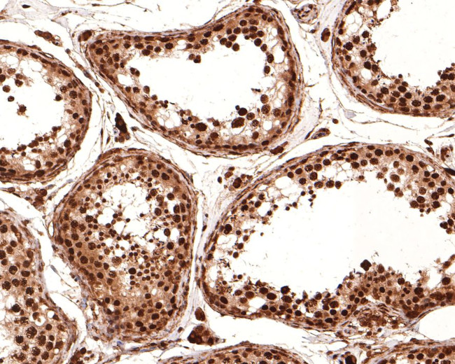 SOX3 Antibody in Immunohistochemistry (Paraffin) (IHC (P))