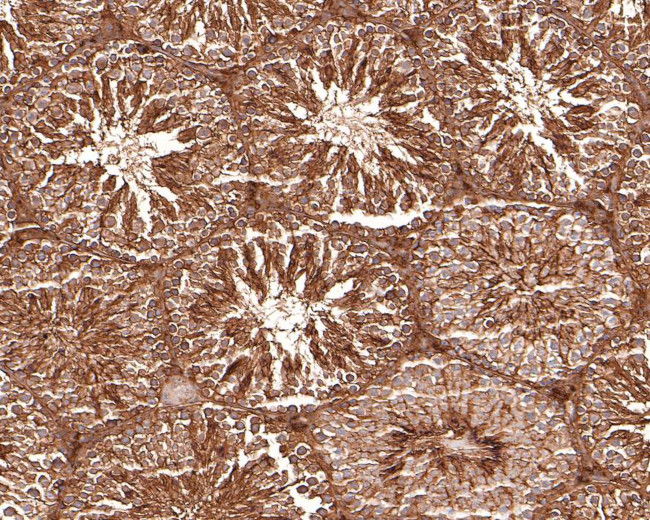 RRAS2 Antibody in Immunohistochemistry (Paraffin) (IHC (P))