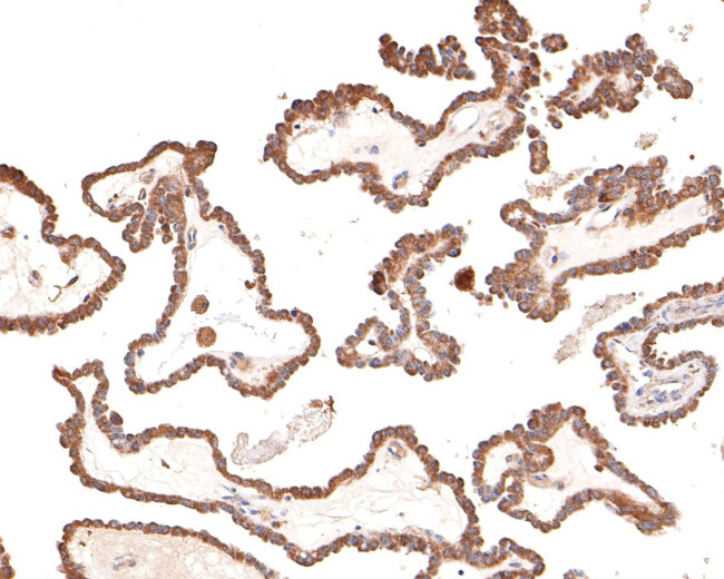 DAB2IP Antibody in Immunohistochemistry (Paraffin) (IHC (P))