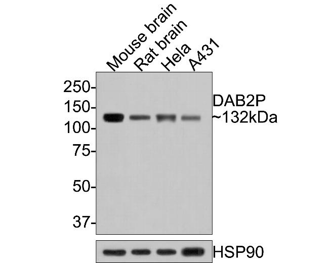 DAB2IP Antibody in Western Blot (WB)