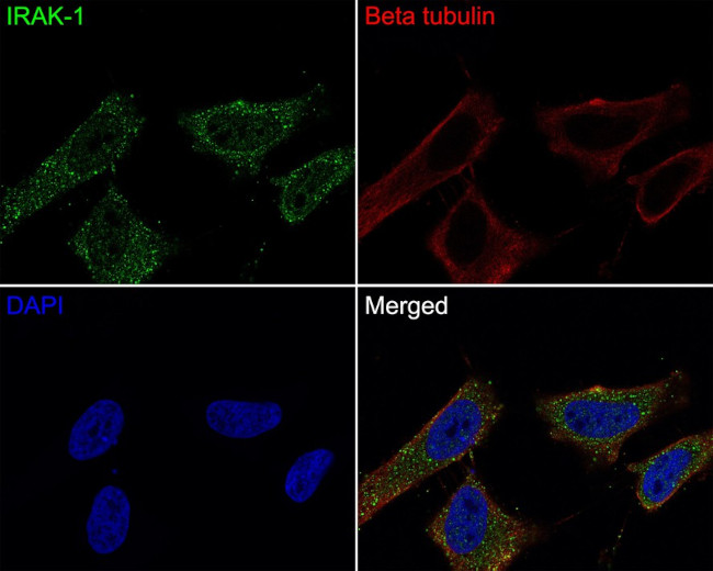 IRAK1 Antibody in Immunocytochemistry (ICC/IF)