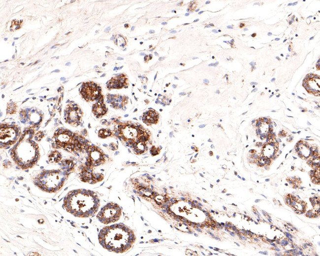 IRAK1 Antibody in Immunohistochemistry (Paraffin) (IHC (P))