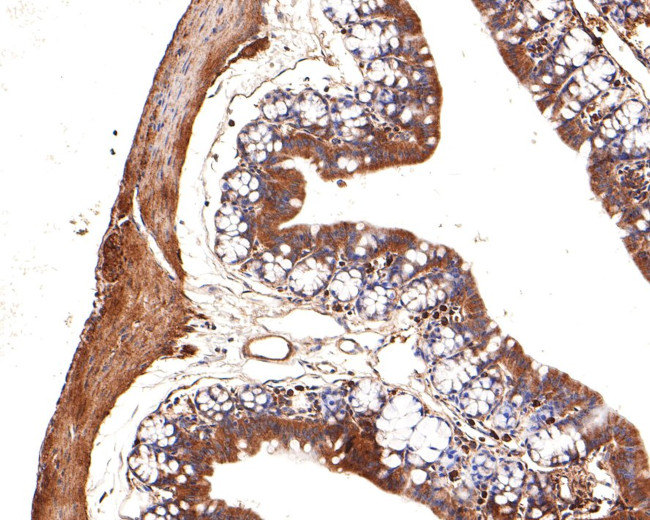 IRAK1 Antibody in Immunohistochemistry (Paraffin) (IHC (P))