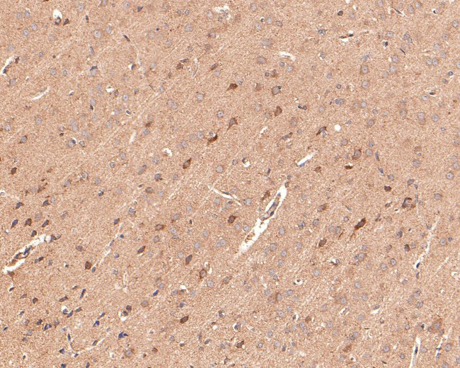 IRAK1 Antibody in Immunohistochemistry (Paraffin) (IHC (P))