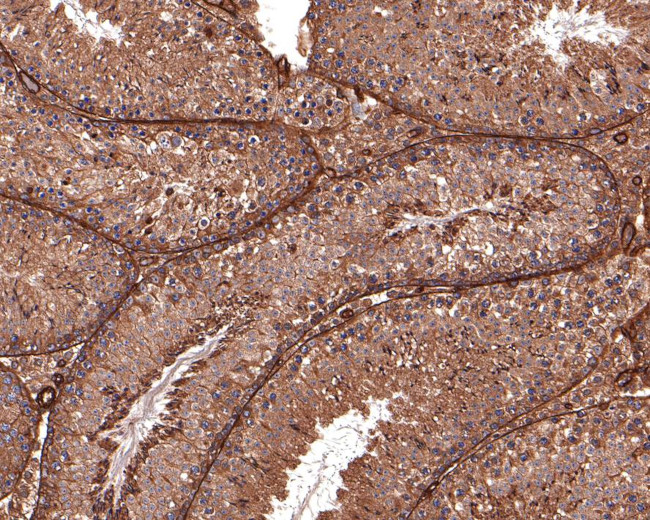 14-3-3 zeta Antibody in Immunohistochemistry (Paraffin) (IHC (P))