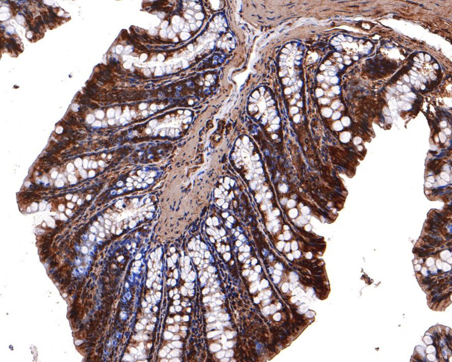 14-3-3 zeta Antibody in Immunohistochemistry (Paraffin) (IHC (P))