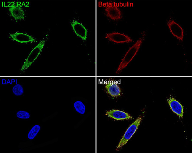 IL22RA2 Antibody in Immunocytochemistry (ICC/IF)