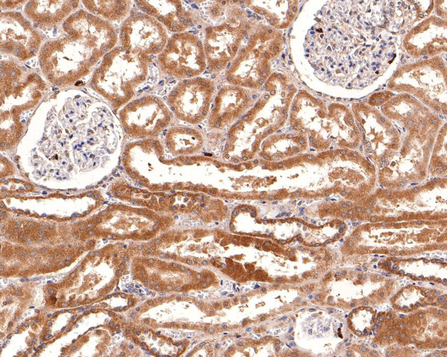 IL22RA2 Antibody in Immunohistochemistry (Paraffin) (IHC (P))