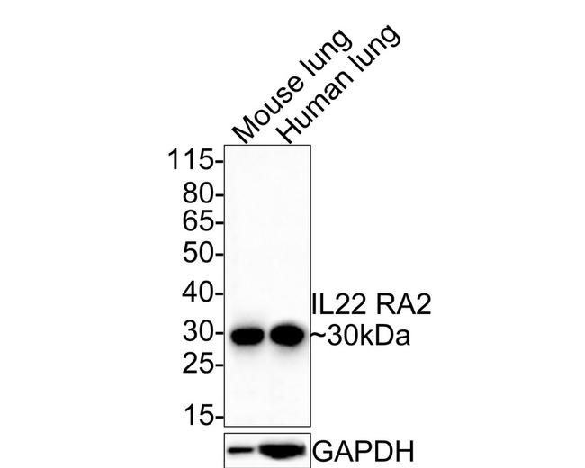 IL22RA2 Antibody in Western Blot (WB)