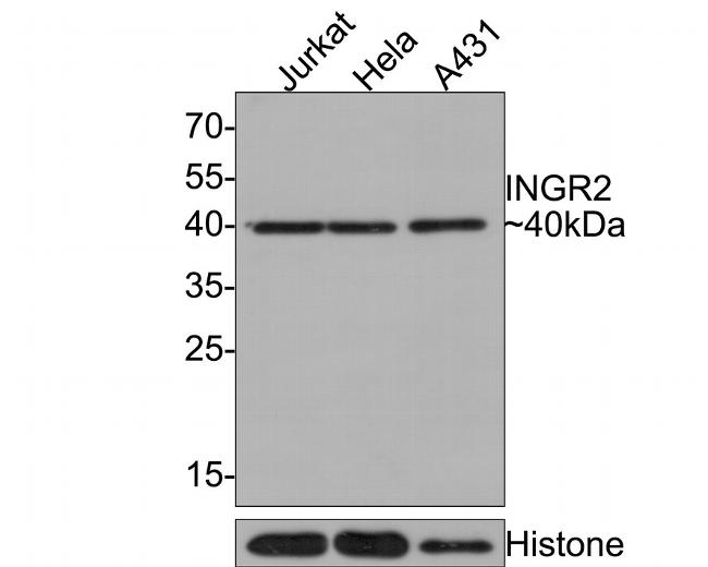 IFNGR2 Antibody in Western Blot (WB)