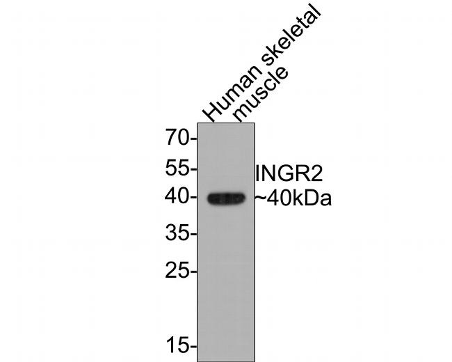 IFNGR2 Antibody in Western Blot (WB)