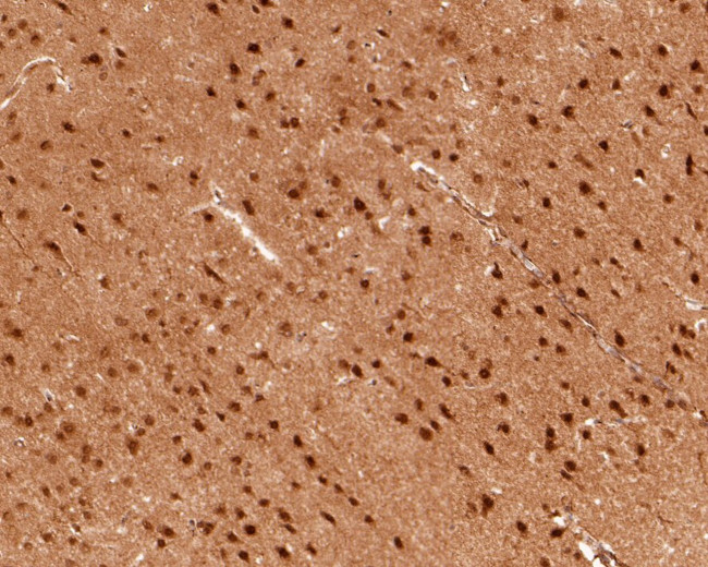 PSMC6 Antibody in Immunohistochemistry (Paraffin) (IHC (P))