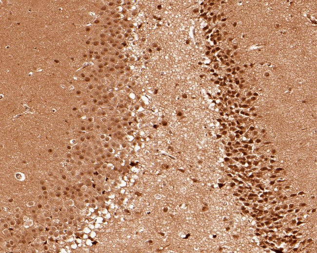 PSMC6 Antibody in Immunohistochemistry (Paraffin) (IHC (P))