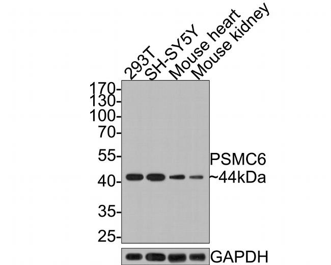 PSMC6 Antibody in Western Blot (WB)