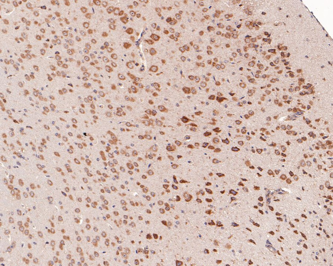 YTHDF1 Antibody in Immunohistochemistry (Paraffin) (IHC (P))