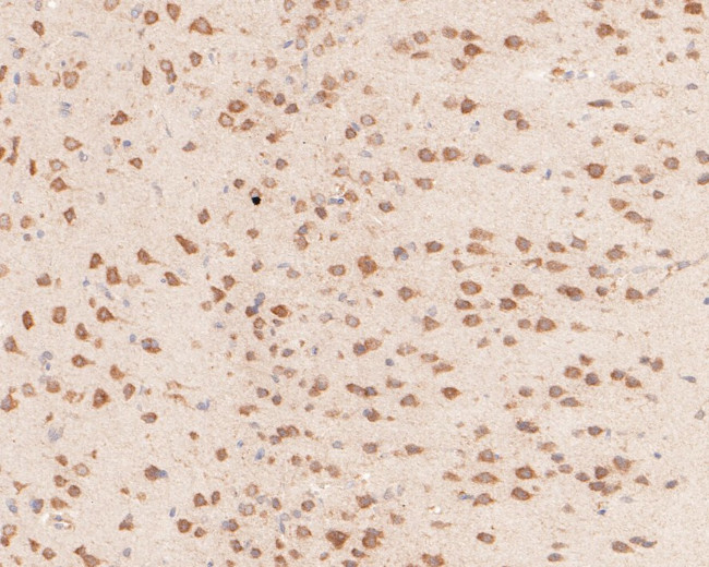 YTHDF1 Antibody in Immunohistochemistry (Paraffin) (IHC (P))