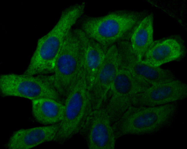 TRPV6 Antibody in Immunocytochemistry (ICC/IF)