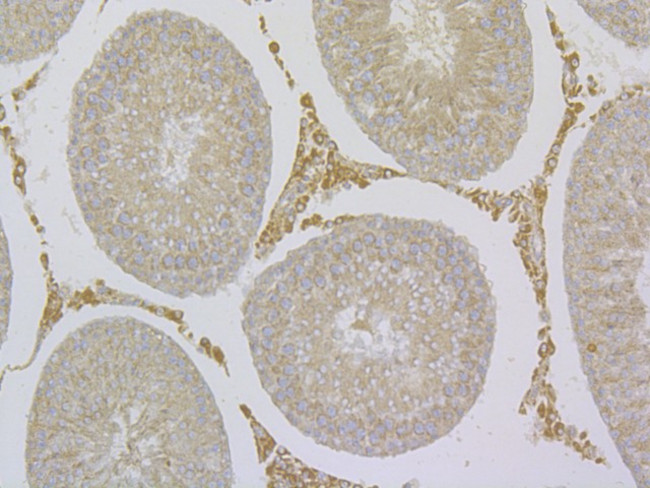 TRPV6 Antibody in Immunohistochemistry (Paraffin) (IHC (P))