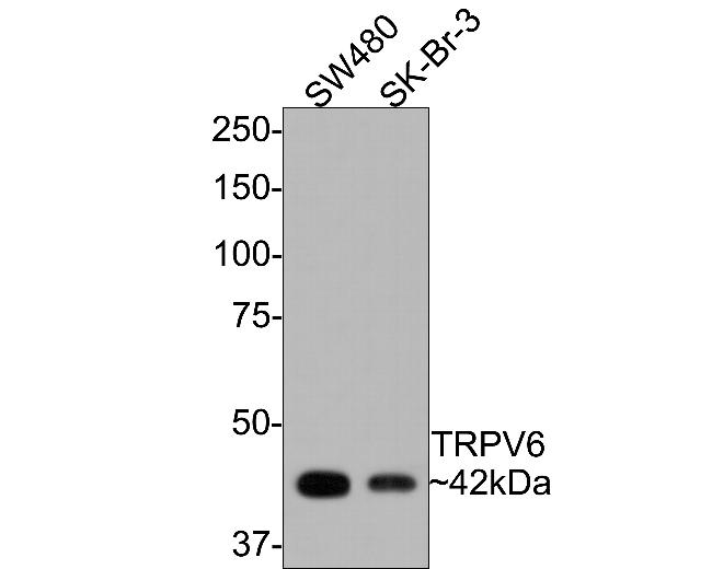 TRPV6 Antibody in Western Blot (WB)