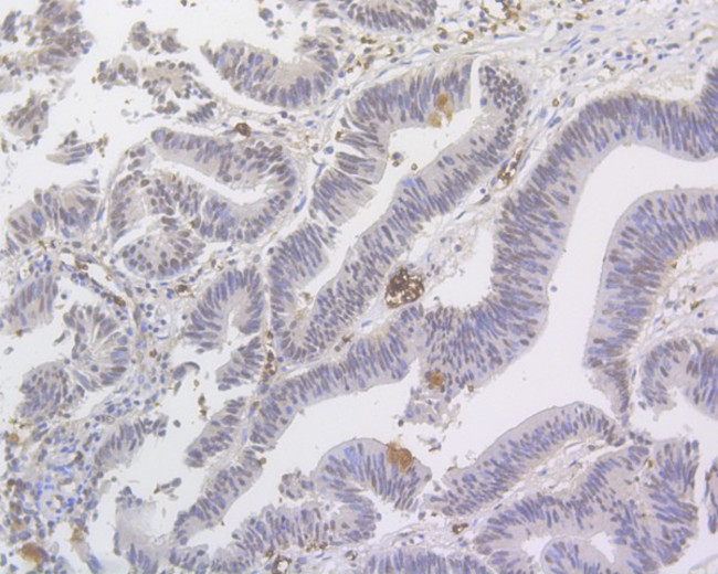 MED12 Antibody in Immunohistochemistry (Paraffin) (IHC (P))