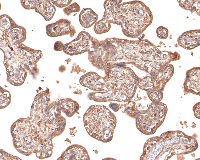 IL12RB1 Antibody in Immunohistochemistry (Paraffin) (IHC (P))