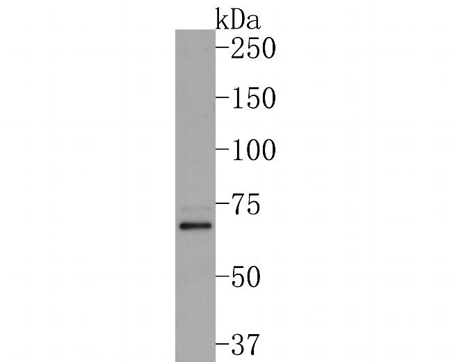 IL12RB1 Antibody in Western Blot (WB)