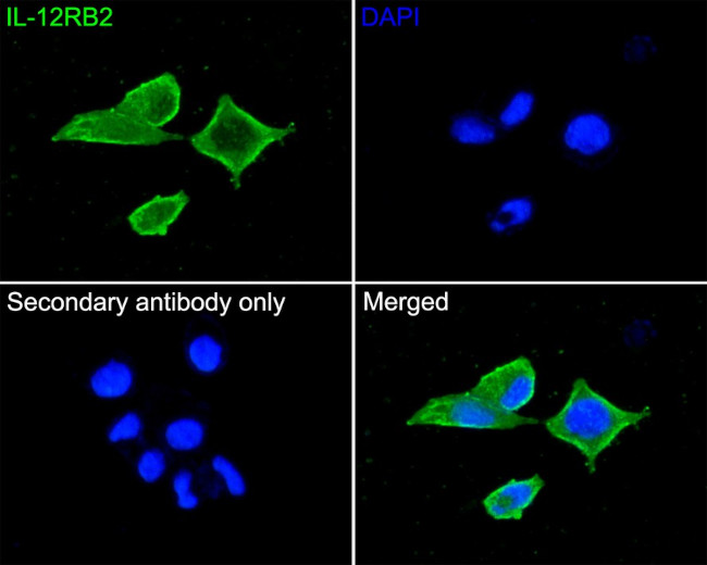 IL12RB2 Antibody in Immunocytochemistry (ICC/IF)