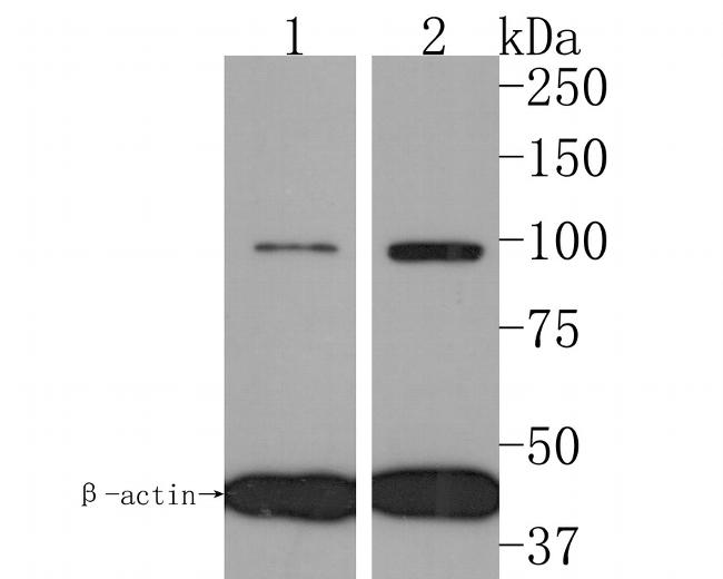 IL12RB2 Antibody in Western Blot (WB)