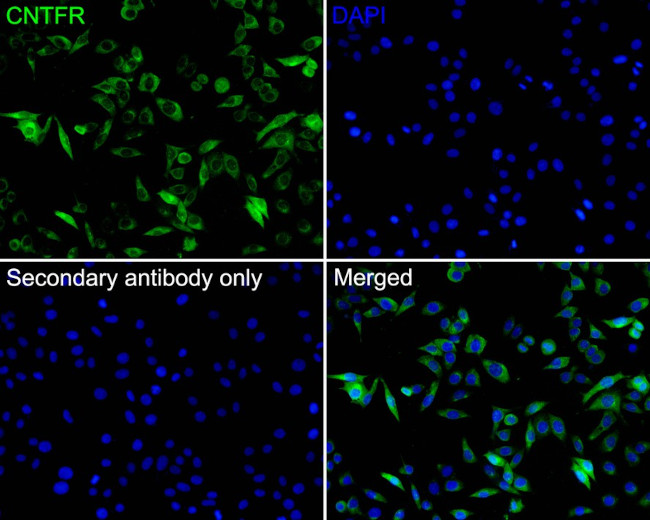 CNTFR Antibody in Immunocytochemistry (ICC/IF)