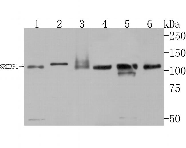 SREBP1 Antibody in Western Blot (WB)