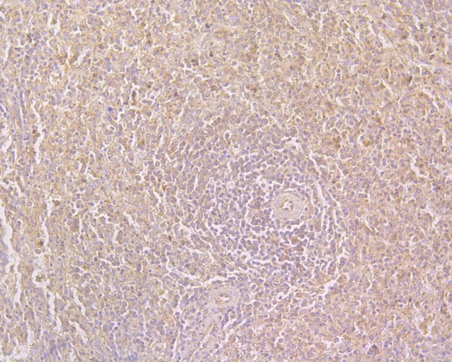 CD244 Antibody in Immunohistochemistry (Paraffin) (IHC (P))