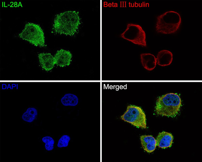 IL-28A Antibody in Immunocytochemistry (ICC/IF)