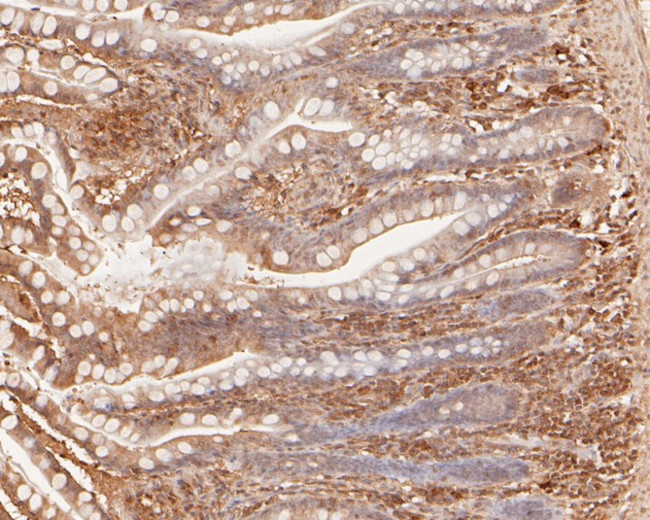 IL-28A Antibody in Immunohistochemistry (Paraffin) (IHC (P))