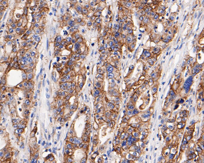 Claudin 18 Antibody in Immunohistochemistry (Paraffin) (IHC (P))