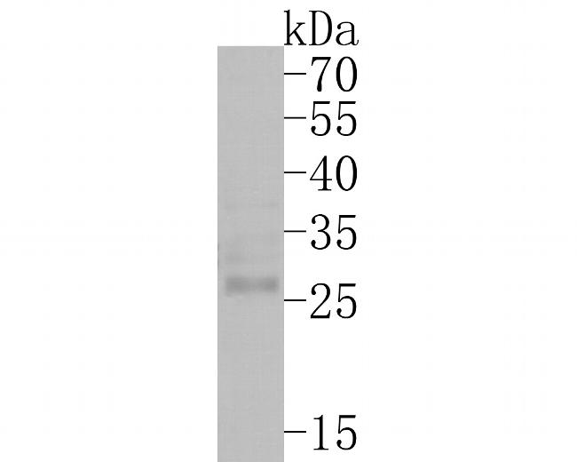 Claudin 18 Antibody in Western Blot (WB)