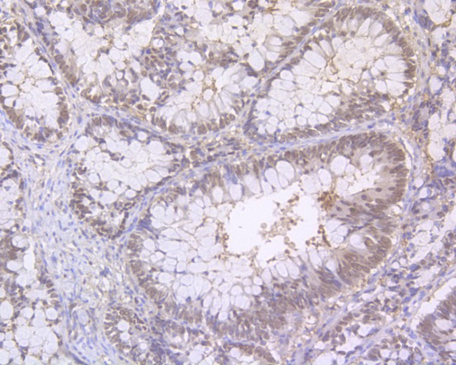 RANBP1 Antibody in Immunohistochemistry (Paraffin) (IHC (P))