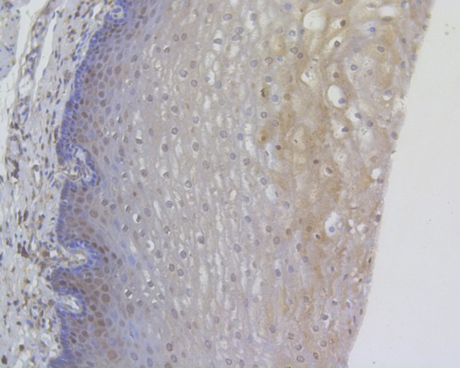 RANBP1 Antibody in Immunohistochemistry (Paraffin) (IHC (P))