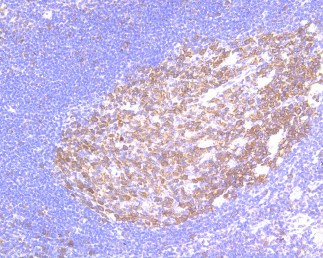 RANBP1 Antibody in Immunohistochemistry (Paraffin) (IHC (P))