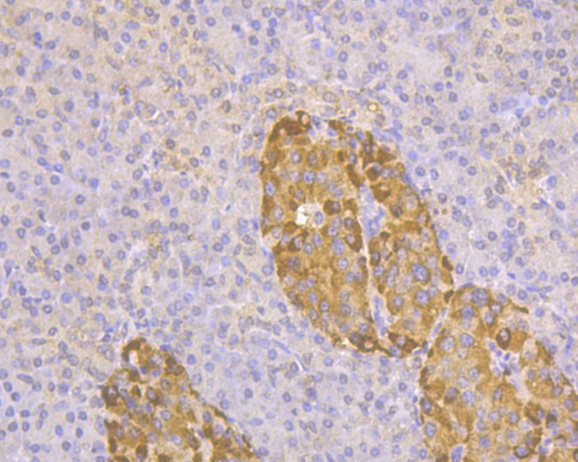 TMPRSS2 Antibody in Immunohistochemistry (Paraffin) (IHC (P))