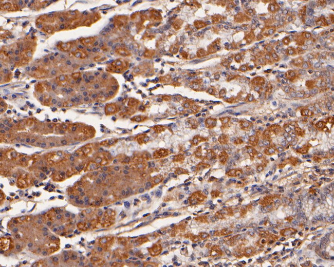 TMPRSS2 Antibody in Immunohistochemistry (Paraffin) (IHC (P))