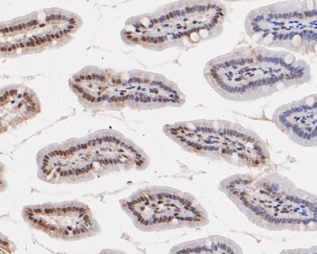 H3K18ac Antibody in Immunohistochemistry (Paraffin) (IHC (P))