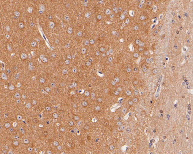 Dynamin 3 Antibody in Immunohistochemistry (Paraffin) (IHC (P))