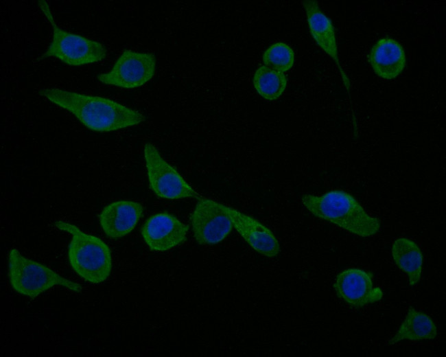 cGAS Antibody in Immunocytochemistry (ICC/IF)