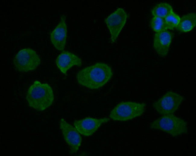 cGAS Antibody in Immunocytochemistry (ICC/IF)