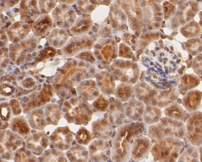 cGAS Antibody in Immunohistochemistry (Paraffin) (IHC (P))