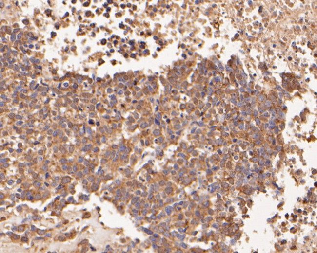 beta Galactosidase Antibody in Immunohistochemistry (Paraffin) (IHC (P))