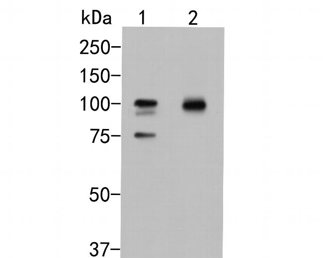 beta Galactosidase Antibody in Western Blot (WB)