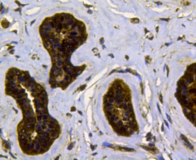 CDK1 Antibody in Immunohistochemistry (Paraffin) (IHC (P))