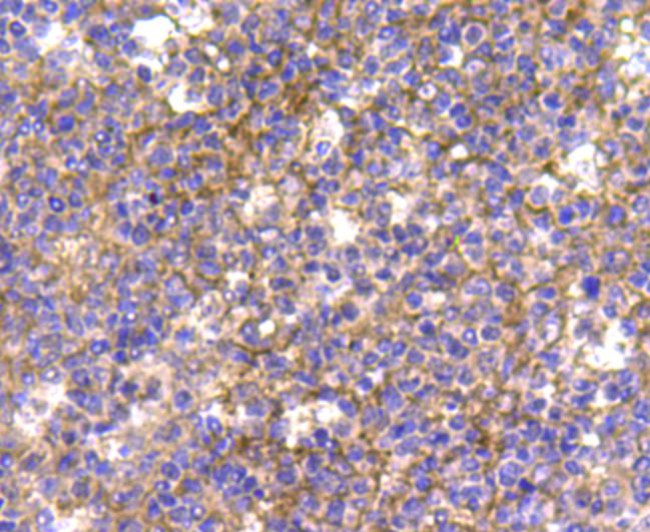 CDK1 Antibody in Immunohistochemistry (Paraffin) (IHC (P))