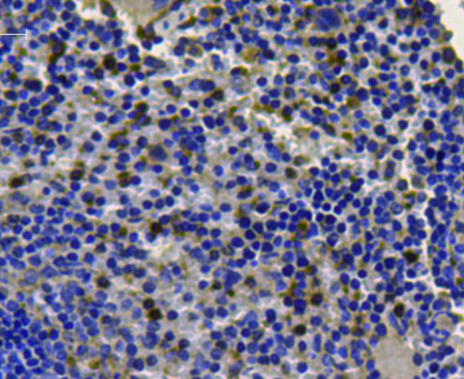 CDK1 Antibody in Immunohistochemistry (Paraffin) (IHC (P))